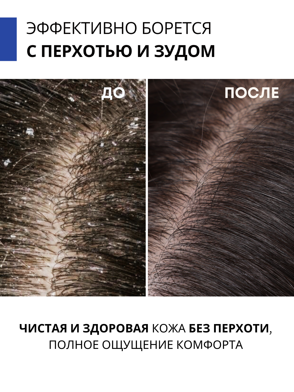 Сыворотка DR. MARCUS HEILER 100 мл - фото 6