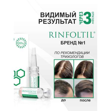 Сыворотка Ринфолтил