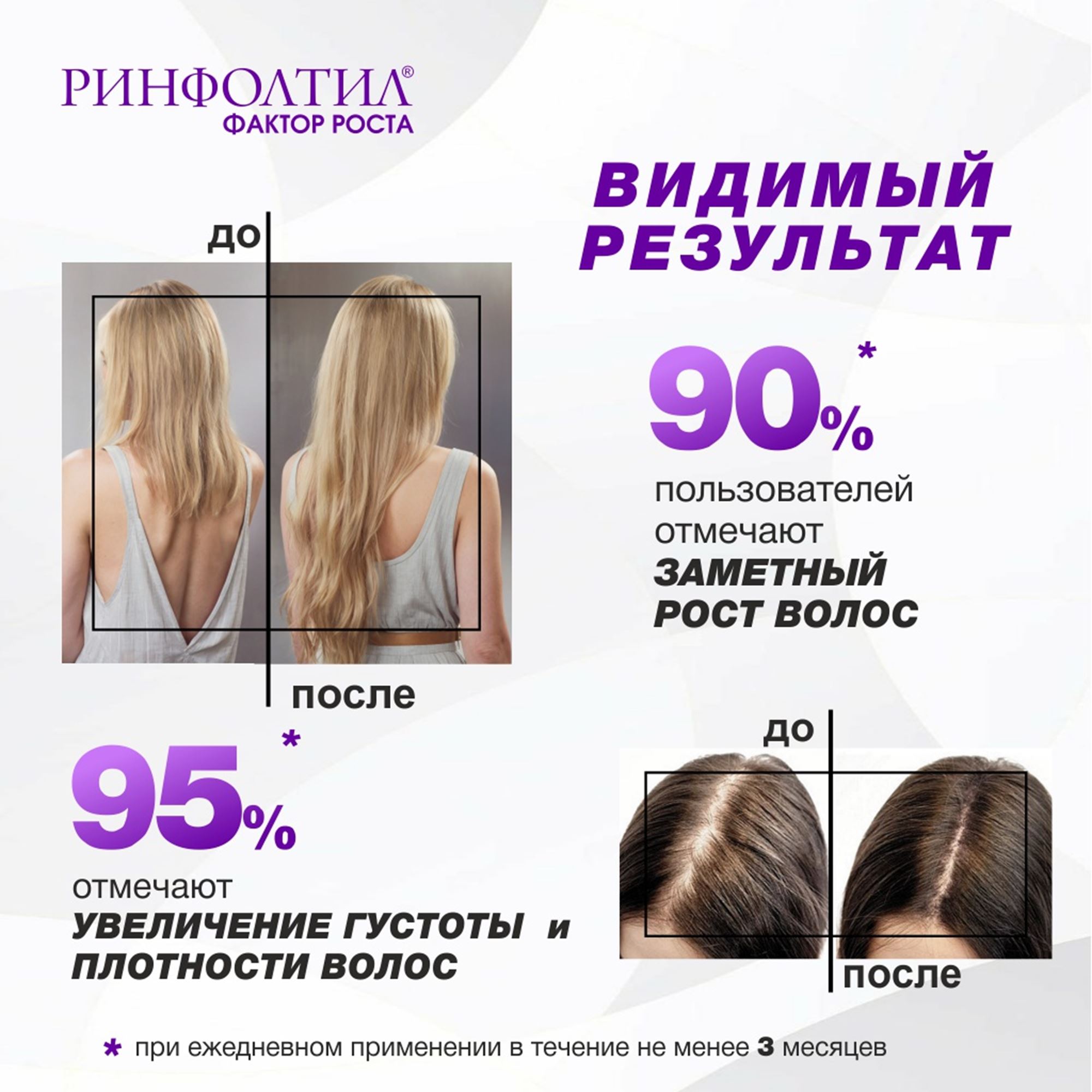 Сыворотка Ринфолтил С пептидами и фактором роста - фото 8