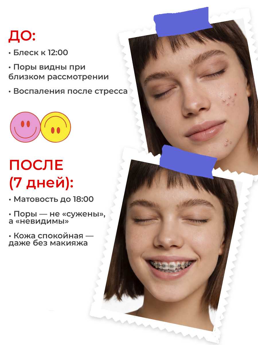 Тоник EDEN Stop Acne 150 мл - фото 5
