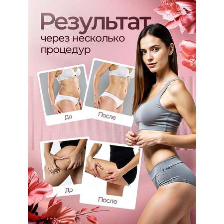 Вакуумный массажер антицеллюлитный CASTLELADY с lpg эффектом, лимфодренажный аппарат для похудения