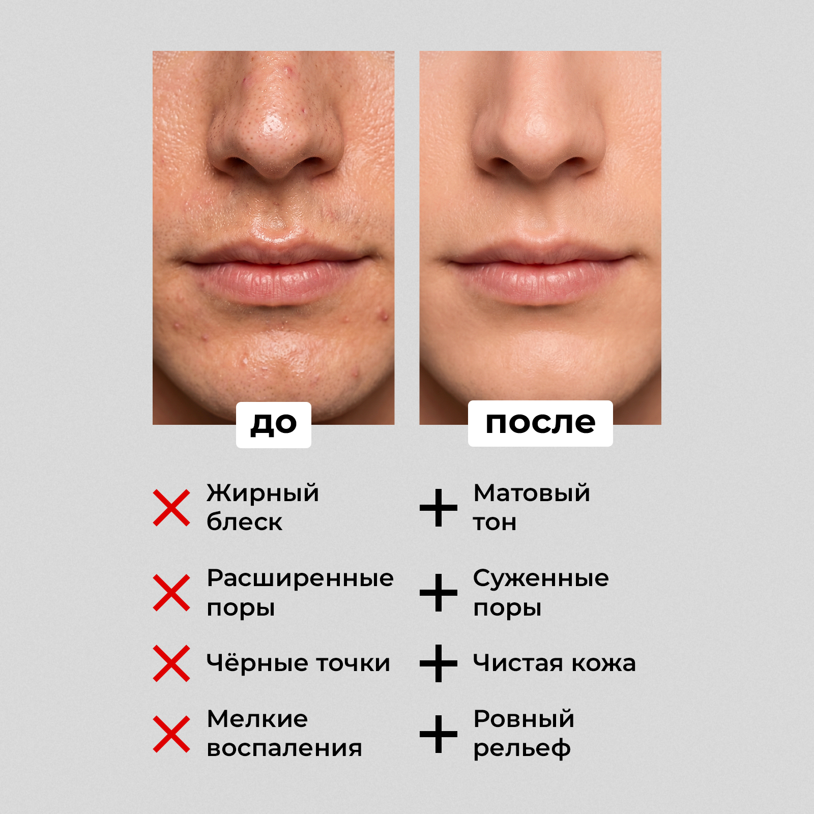 Гель MyMania 200 мл 1 шт. - фото 3