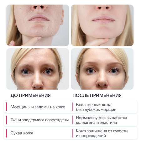 Сыворотка Glatte 30 мл
