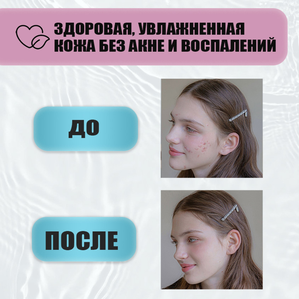 Крем EDEN Stop Acne 50 мл - фото 3