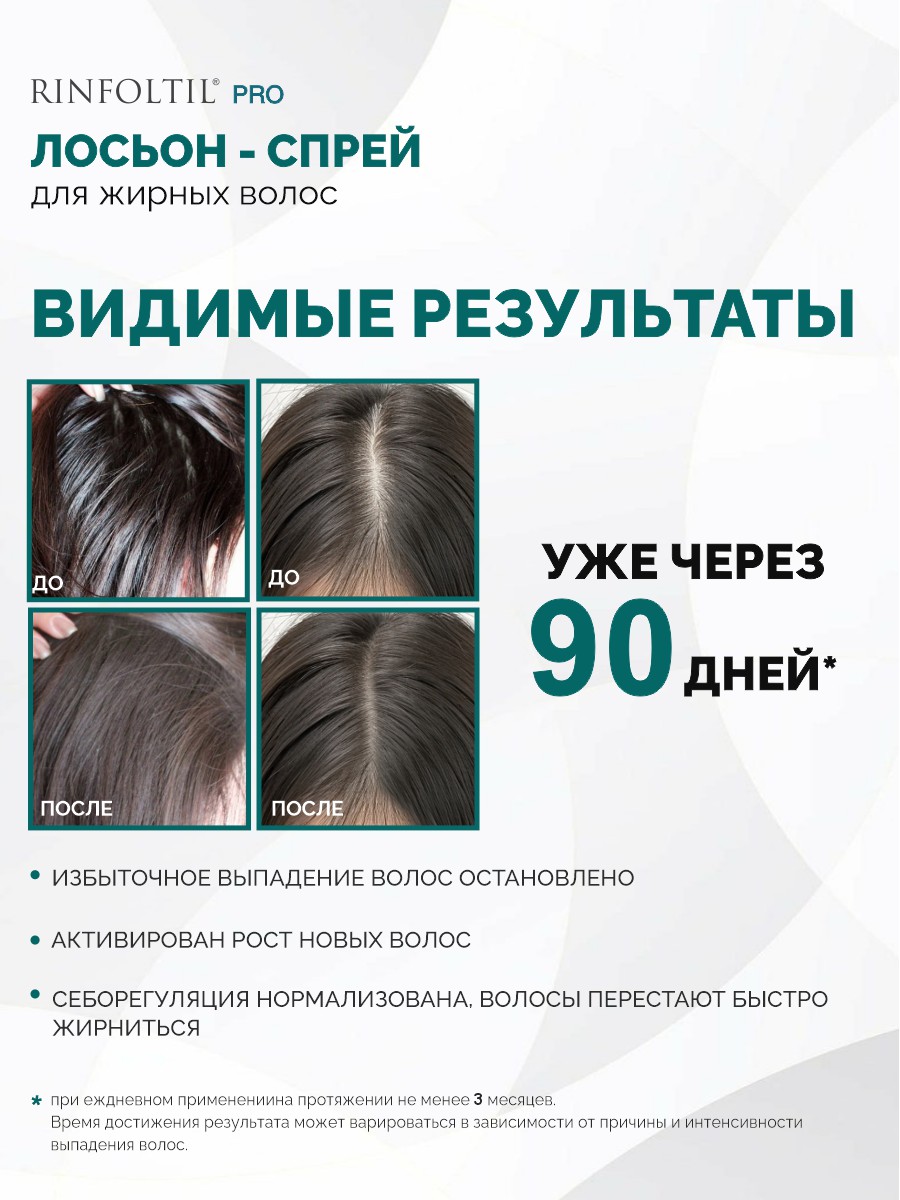 Спрей Ринфолтил От выпадения Для жирной кожи 100 мл - фото 4
