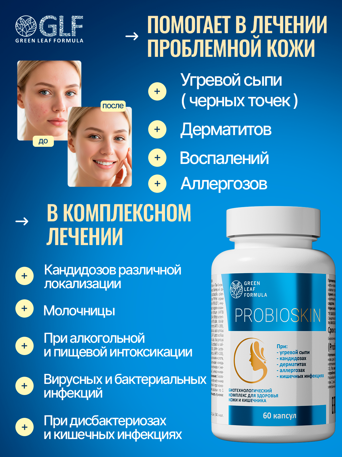 Пробиотик от акне Green Leaf Formula инулин пребиотик симбиотик для кишечника для взрослых от молочницы - фото 2