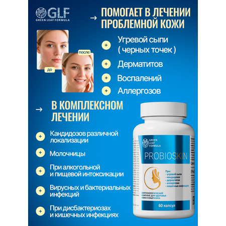 Пробиотик от акне Green Leaf Formula инулин пребиотик симбиотик для кишечника для взрослых от молочницы