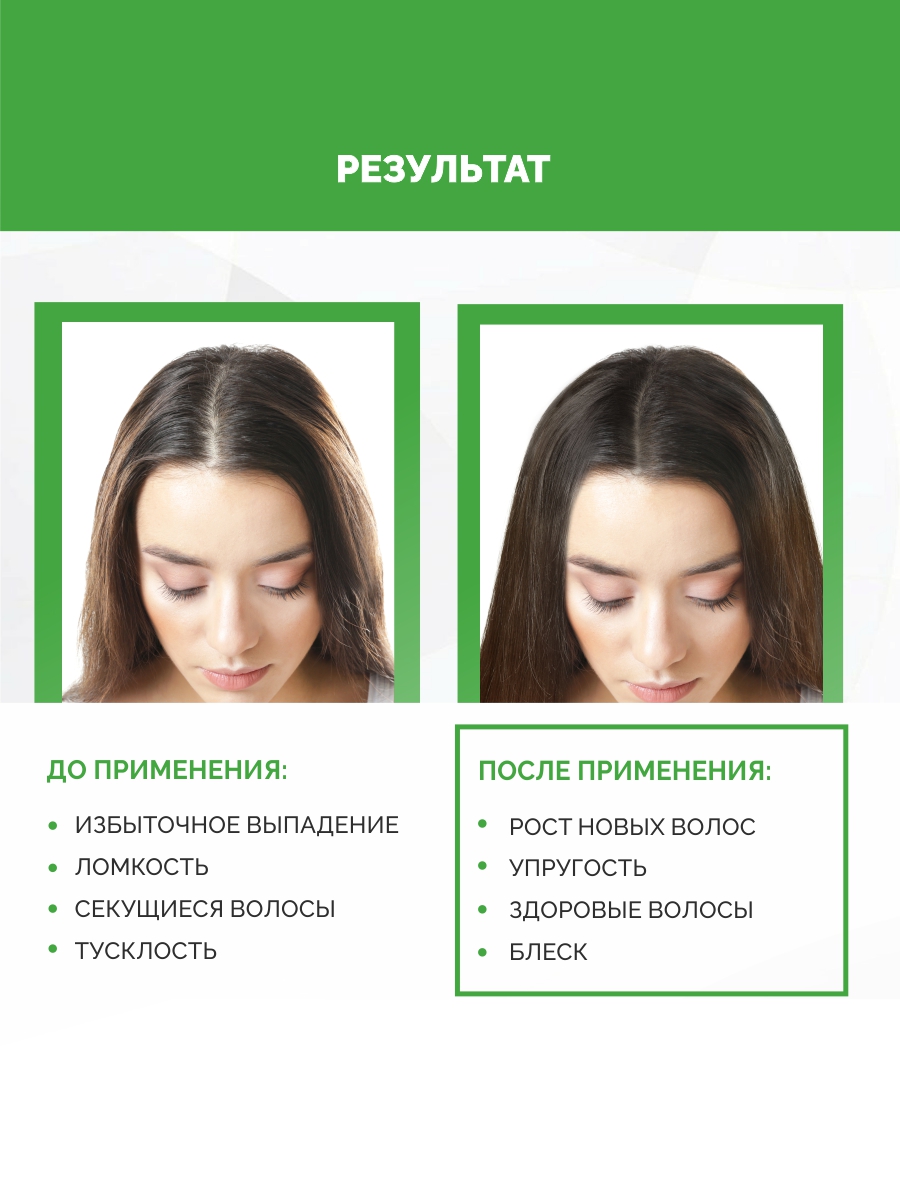 Спрей Ринфолтил от выпадения и для роста волос 100 мл 1 шт. - фото 2