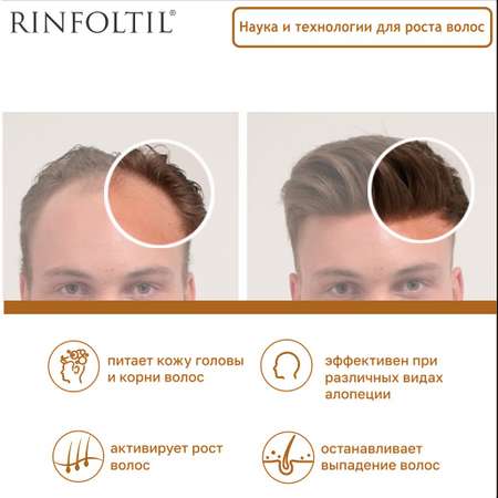Сыворотка Ринфолтил