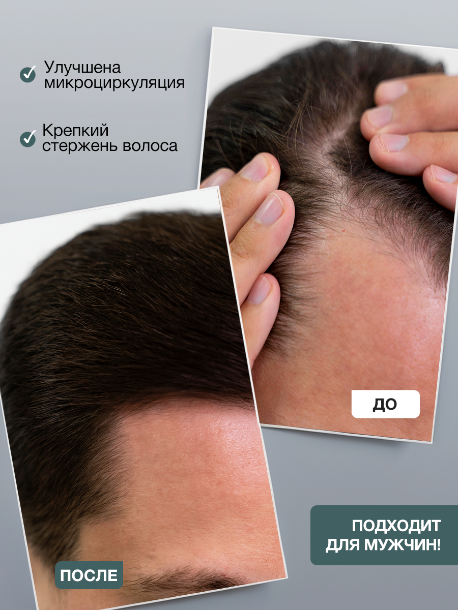 Сыворотка Tashe Professional 100 мл 1 шт. - фото 3