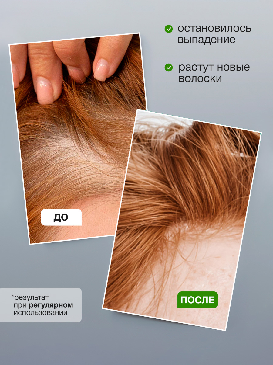 Шампунь Tashe Professional 300 мл - фото 5