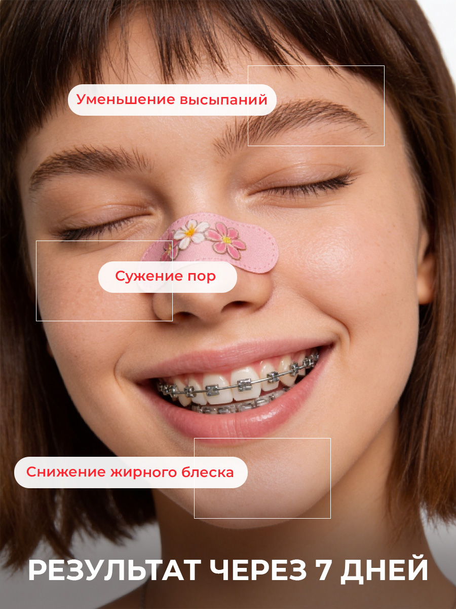 Тоник EDEN Stop Acne 150 мл - фото 2