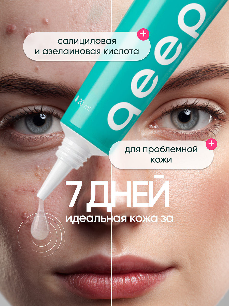 Точечный крем от прыщей qeep Корректор точечный против прыщей, крем от акне - фото 9