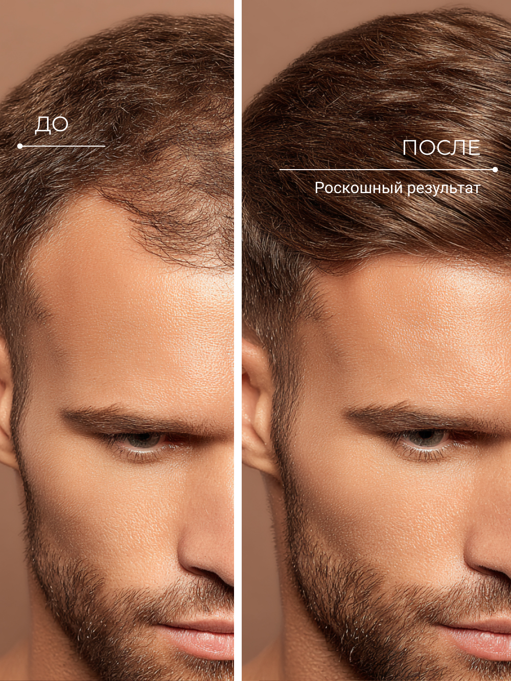 Шампунь Zeitun 250 мл - фото 6