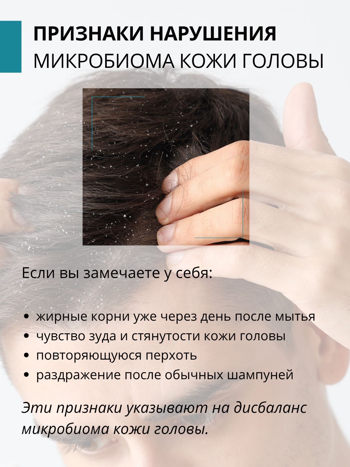 Сыворотка DR. MARCUS HEILER Микробиом баланс от перхоти 100 мл - фото 2