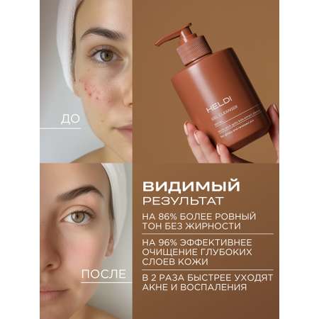 Гель HELDI 300 мл