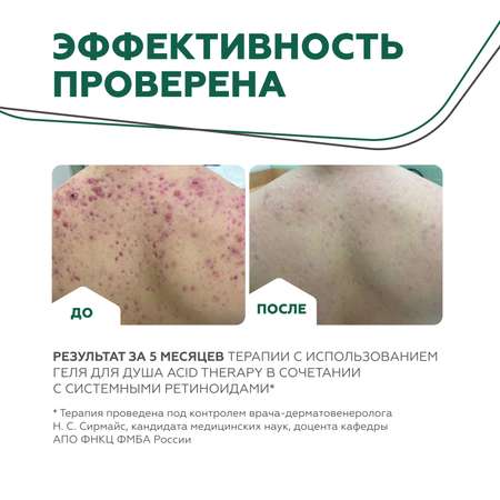 Гель GELTEK 245 мл