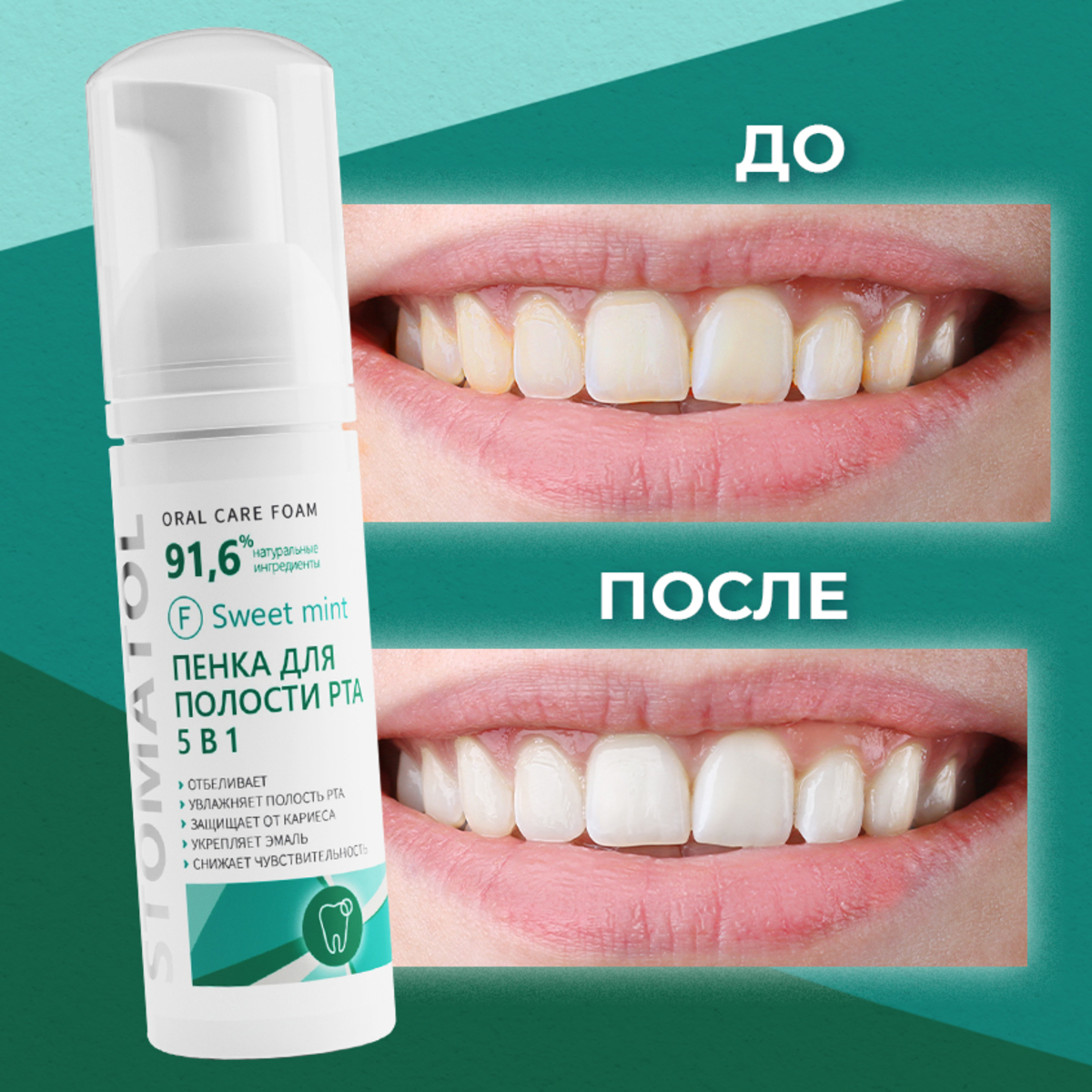 Пенка для полости рта 5в1 STOMATOL увлажняющая Sweet Mint 50 мл - фото 4