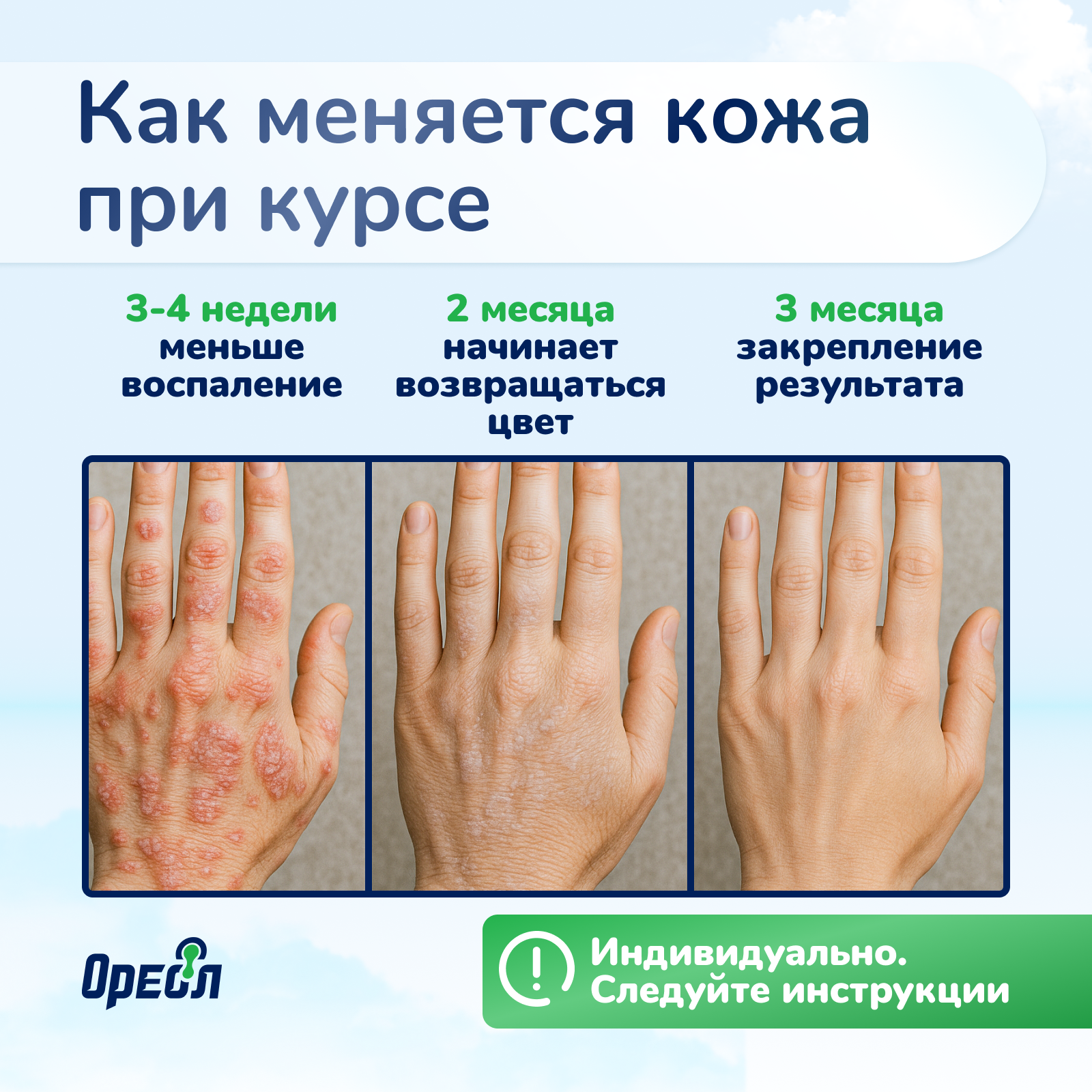 Ультрафиолетовая лампа Ореол Здоровья ОУФК-311 - фото 11