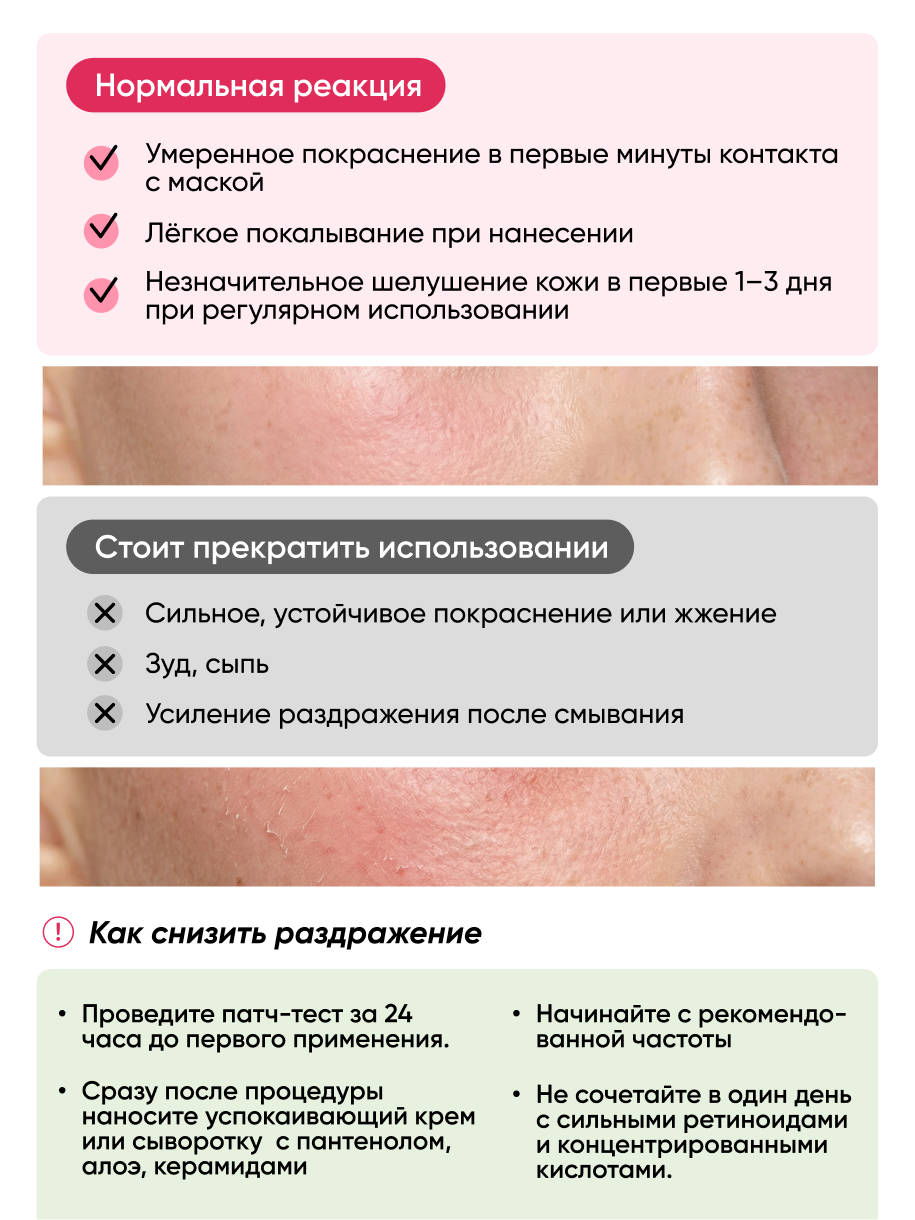 Маска qeep 75 мл - фото 9