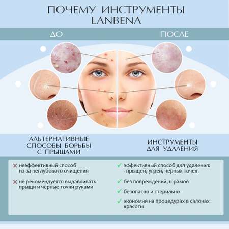 Набор средств LANBENA