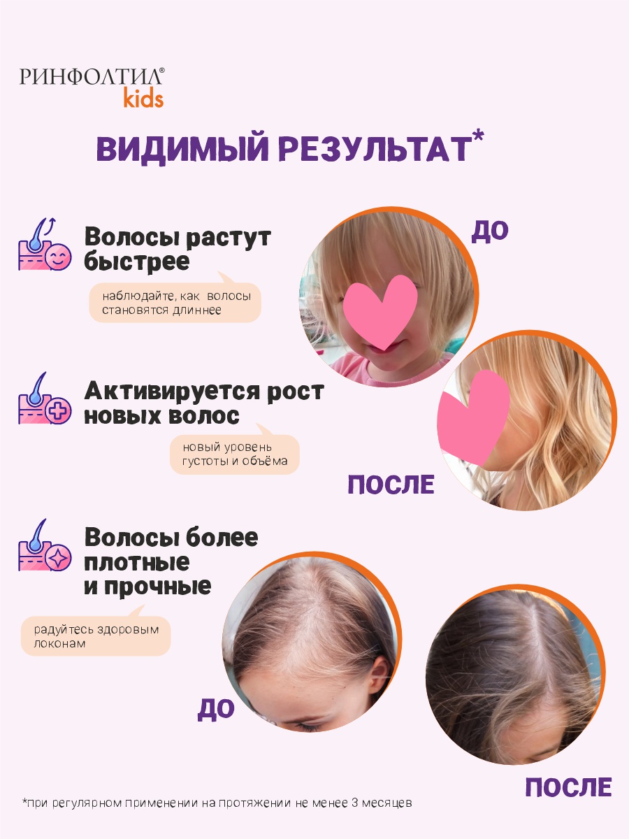 Шампунь Ринфолтил Для детей Для роста волос 230 мл - фото 5