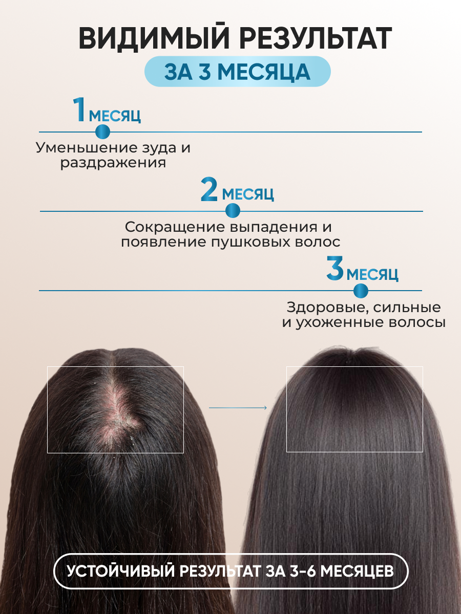 Спрей Ринфолтил 100 мл - фото 3