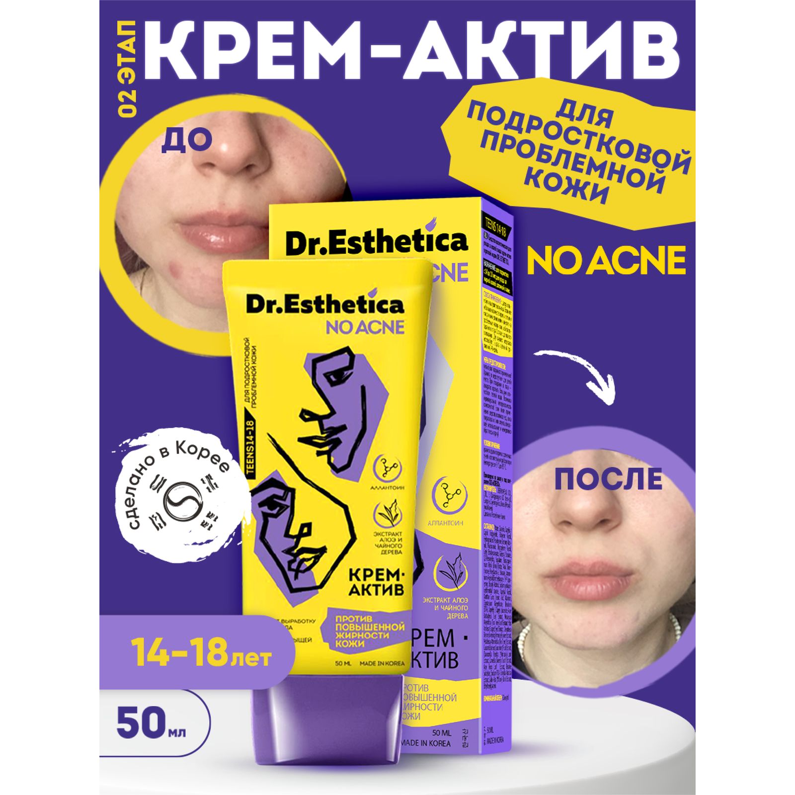 Крем Dr. Esthetica против прыщей 50 мл - фото 4