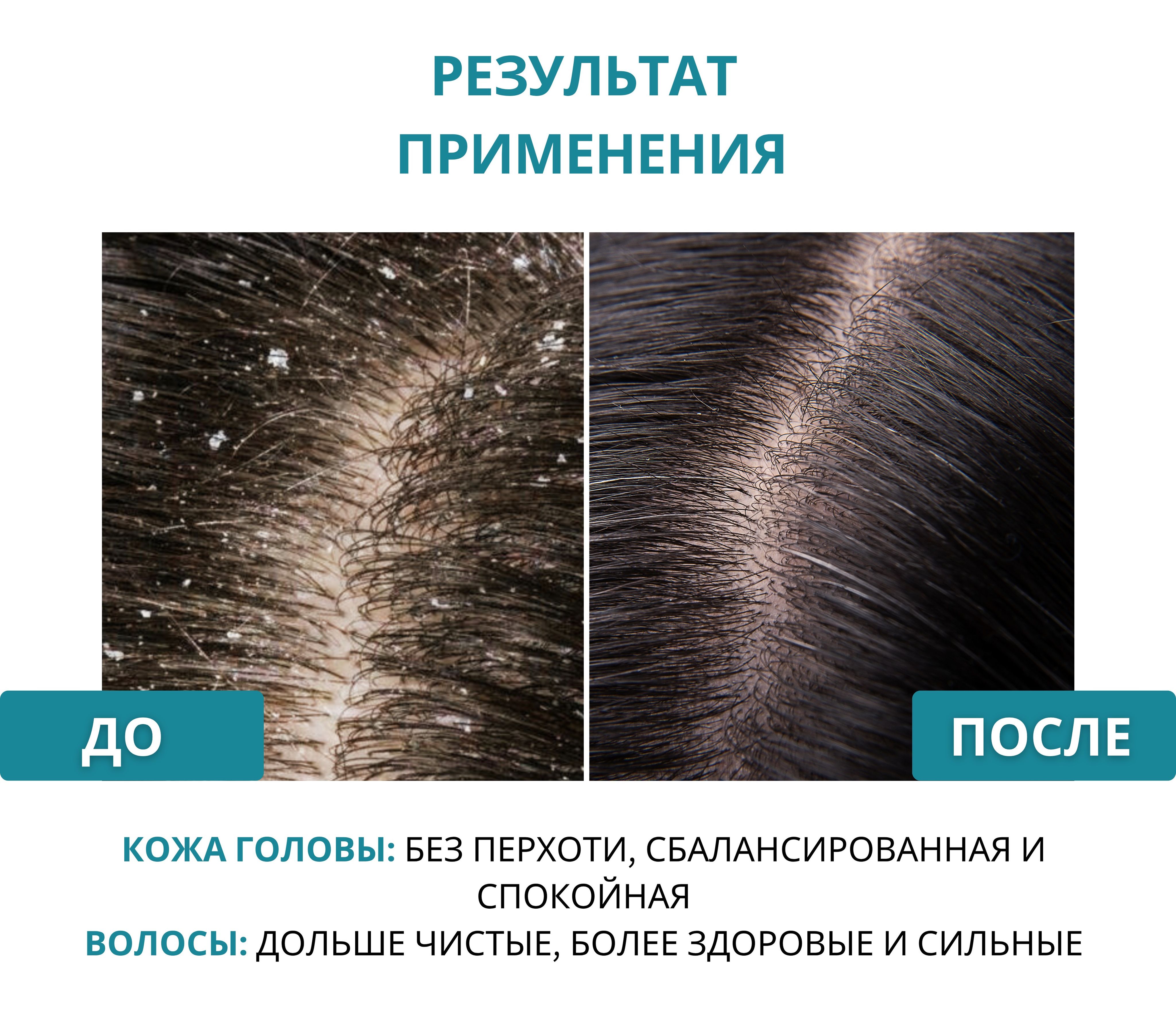 Шампунь DR. MARCUS HEILER Контроль перхоти 250 мл - фото 21