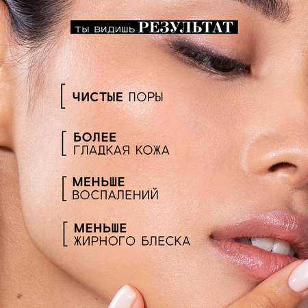 Пилинг BEAUTIFIC ACNE KILLA 30 мл