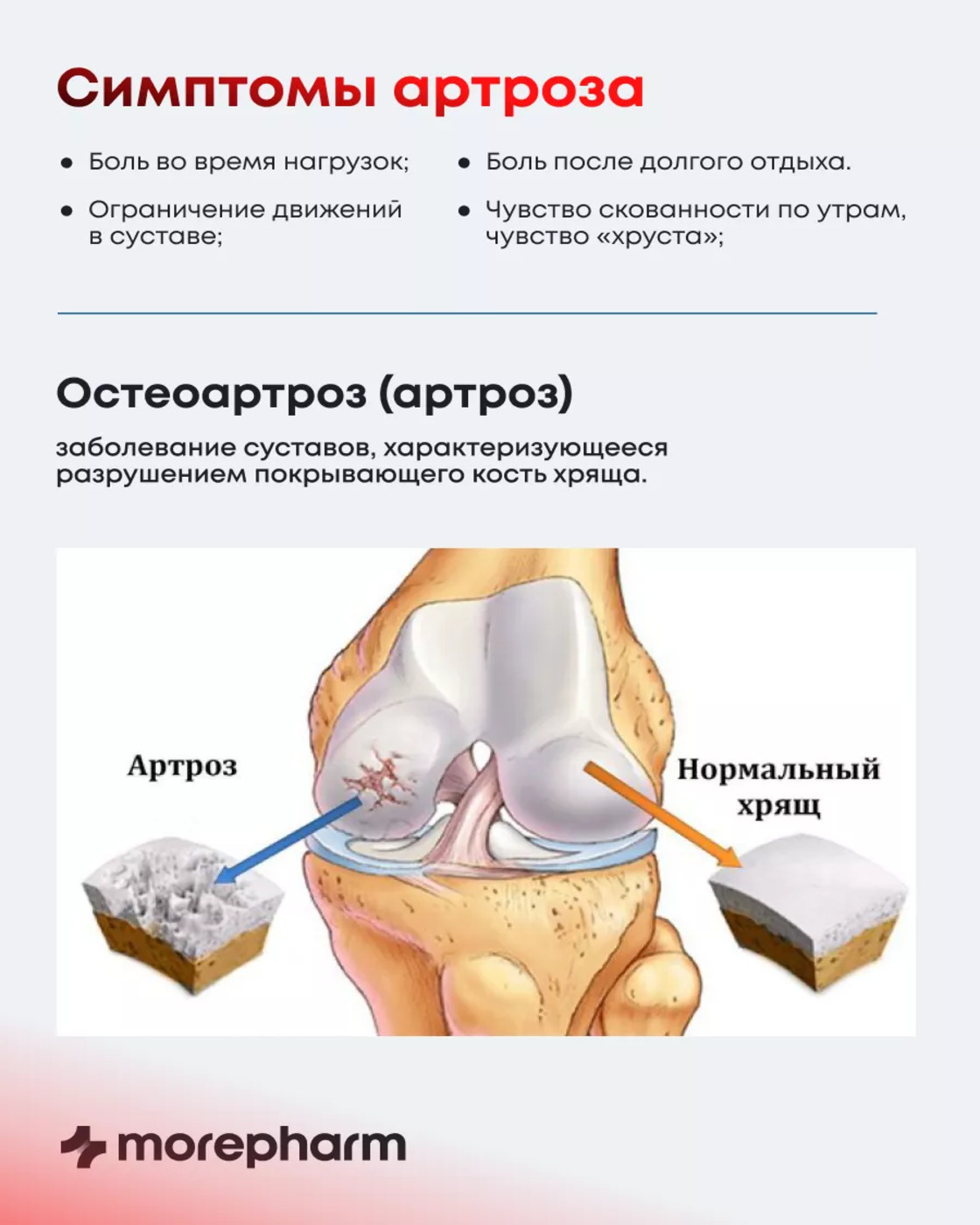 БАД morepharm Глюкозамин хондроитин с Mсм добавка для суставов и связок - фото 8