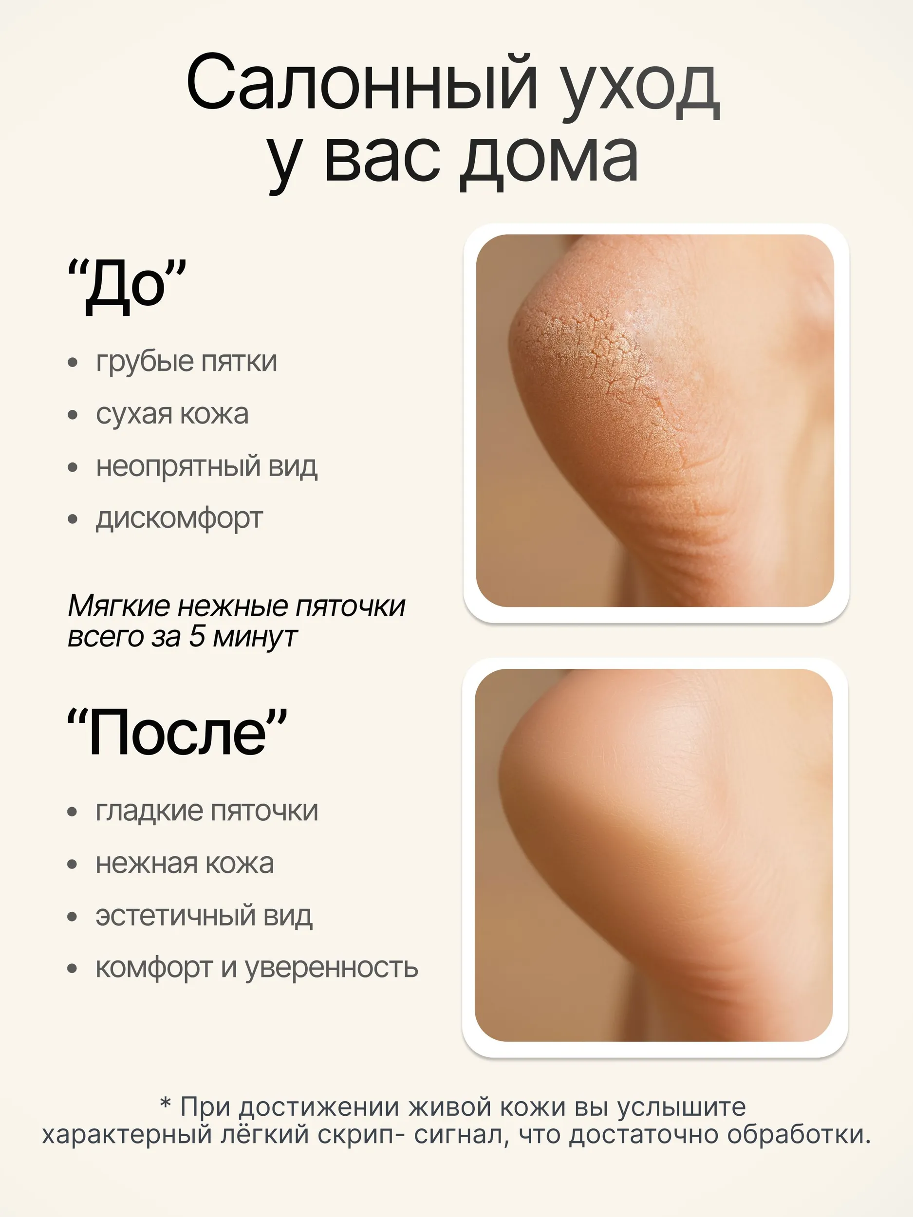 Пилка педикюрная Schere Nagel - фото 2