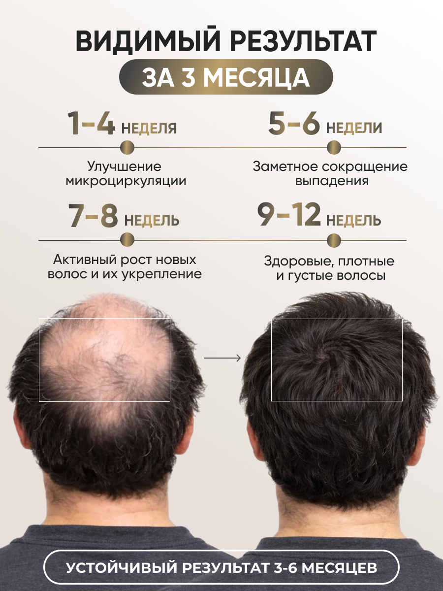 Лосьон Ринфолтил 100 мл - фото 3