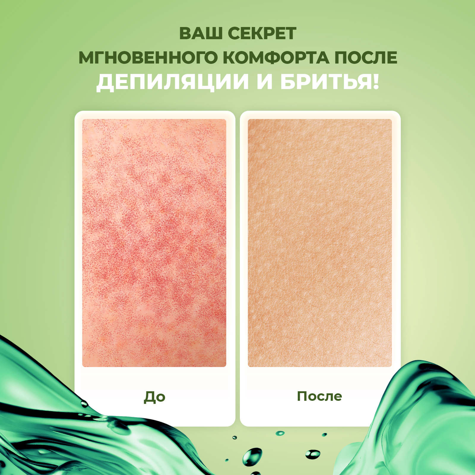 Крем-гель от раздражения YesMix после депиляции, 250 мл - фото 2