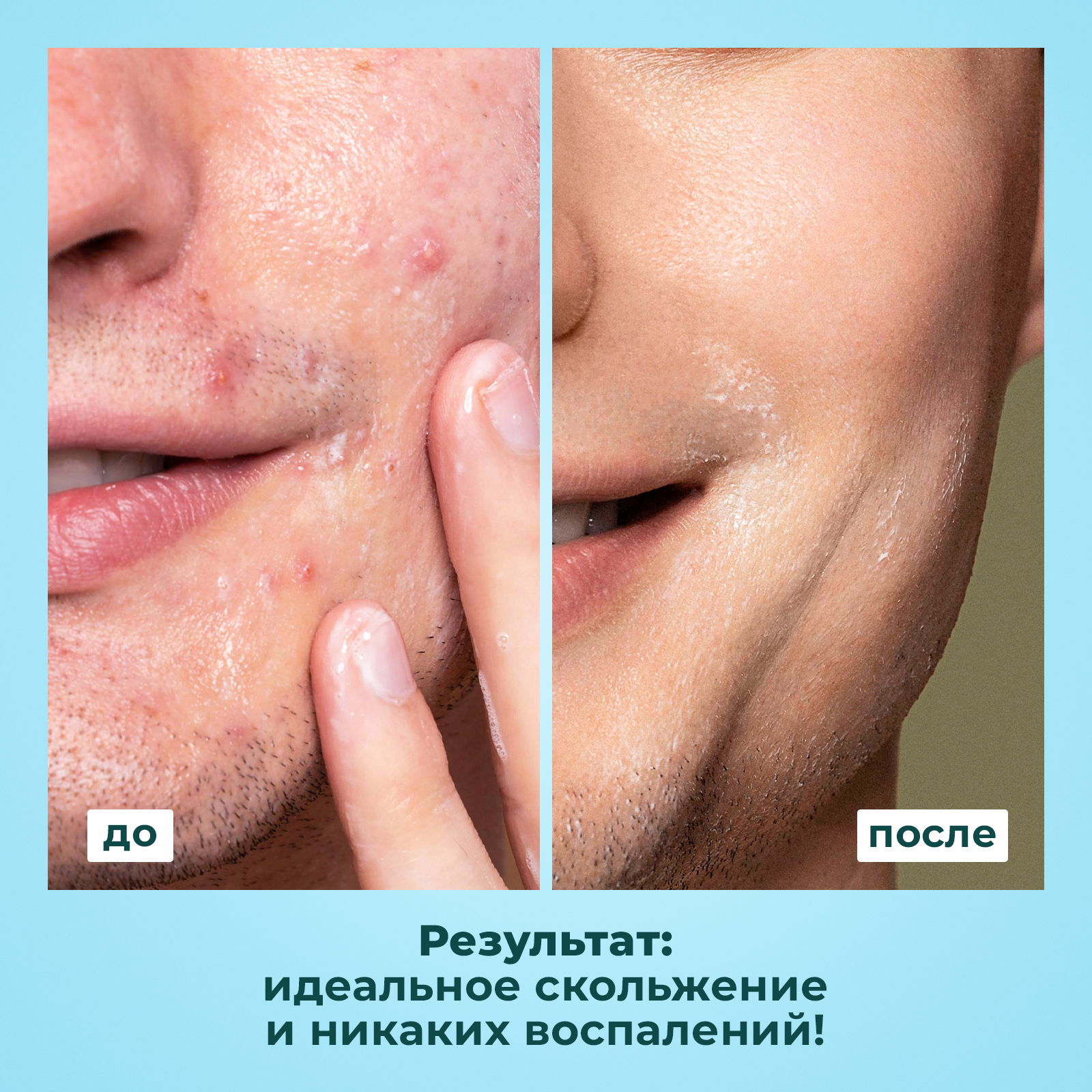 Мужской увлажняющий гель NUZHNOE для бритья чувствительной кожи Сила ментола - фото 2