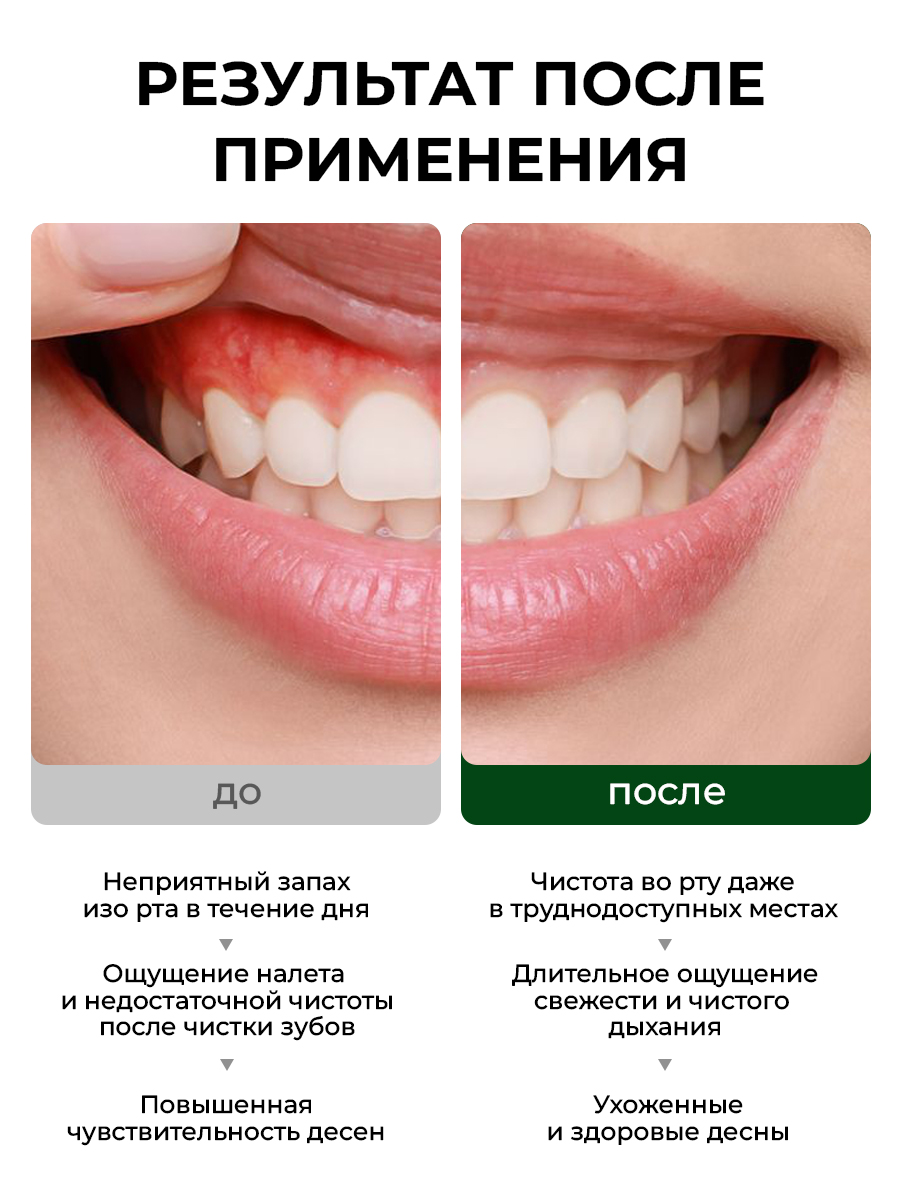 Ополаскиватель STOMATOL Хлоргексидин 500 мл - фото 6