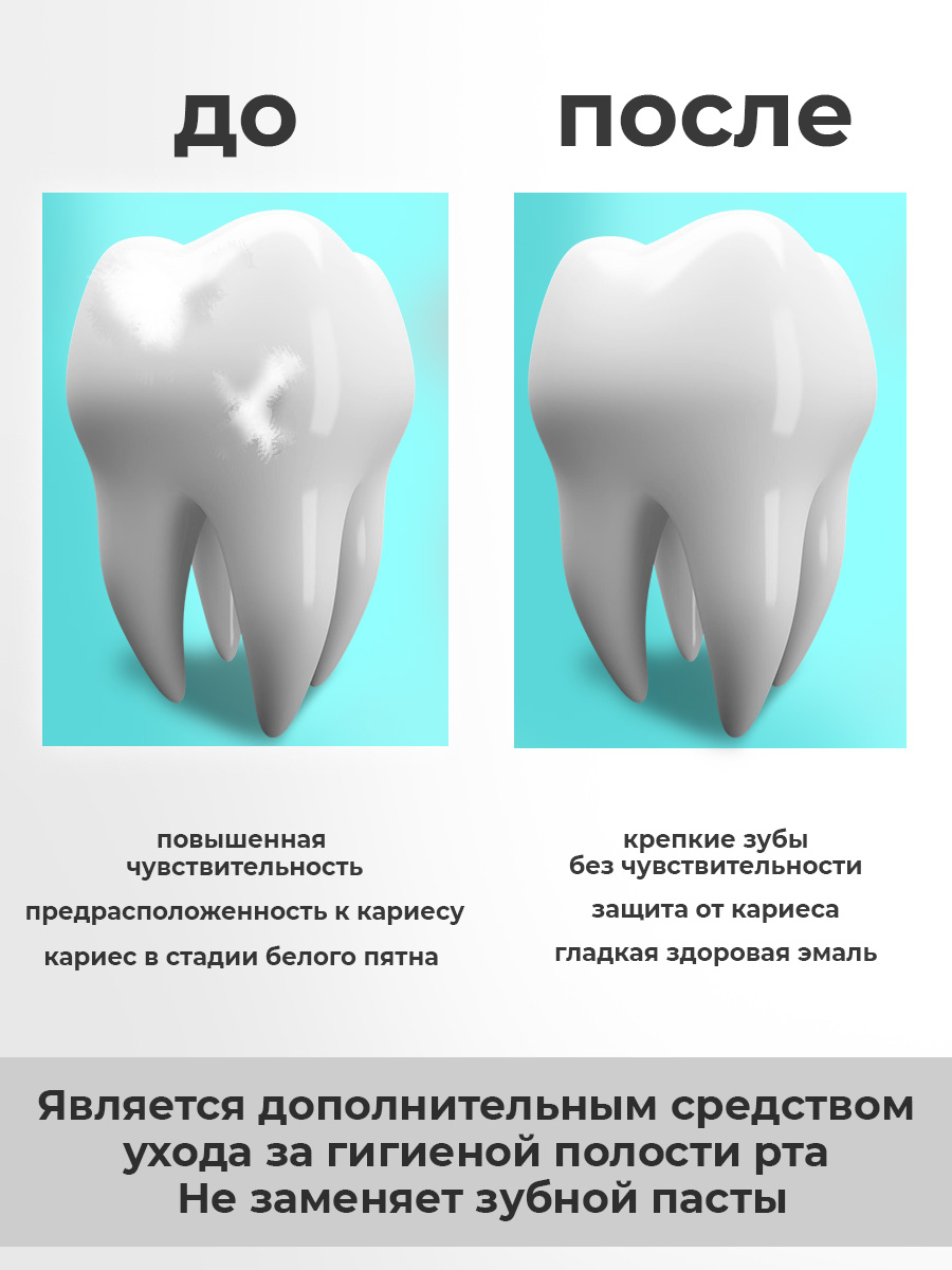 Зубной гель STOMATOL - фото 6