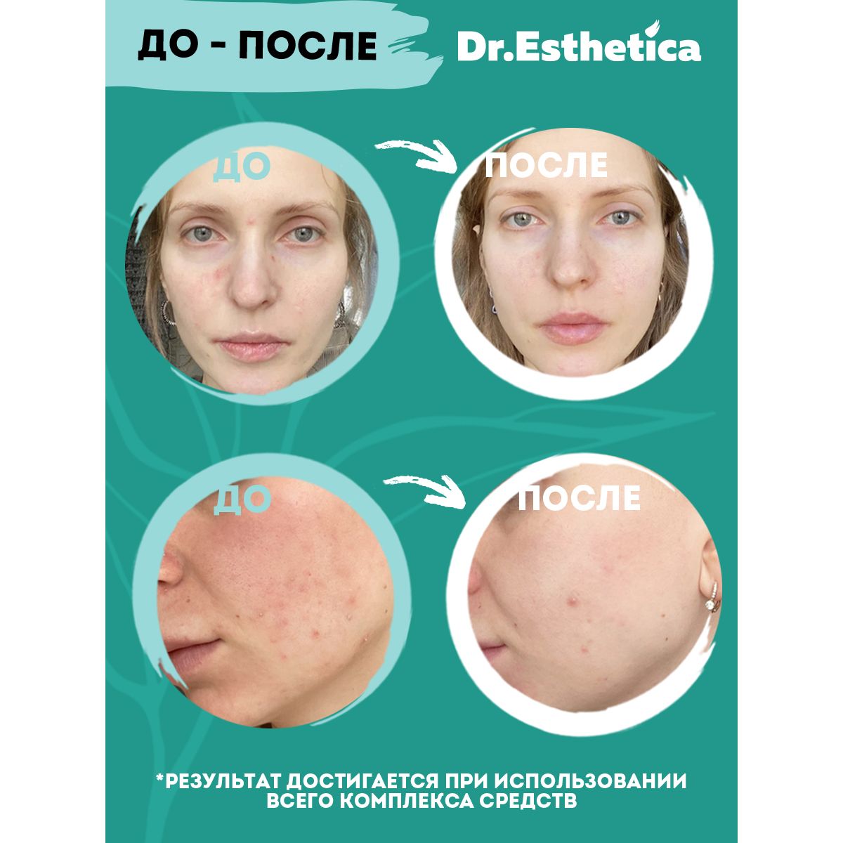 Пена Dr. Esthetica Очищающая 200 мл - фото 9