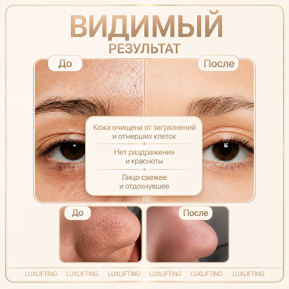 Гель LUXLIFTING распарка 250 мл - фото 7