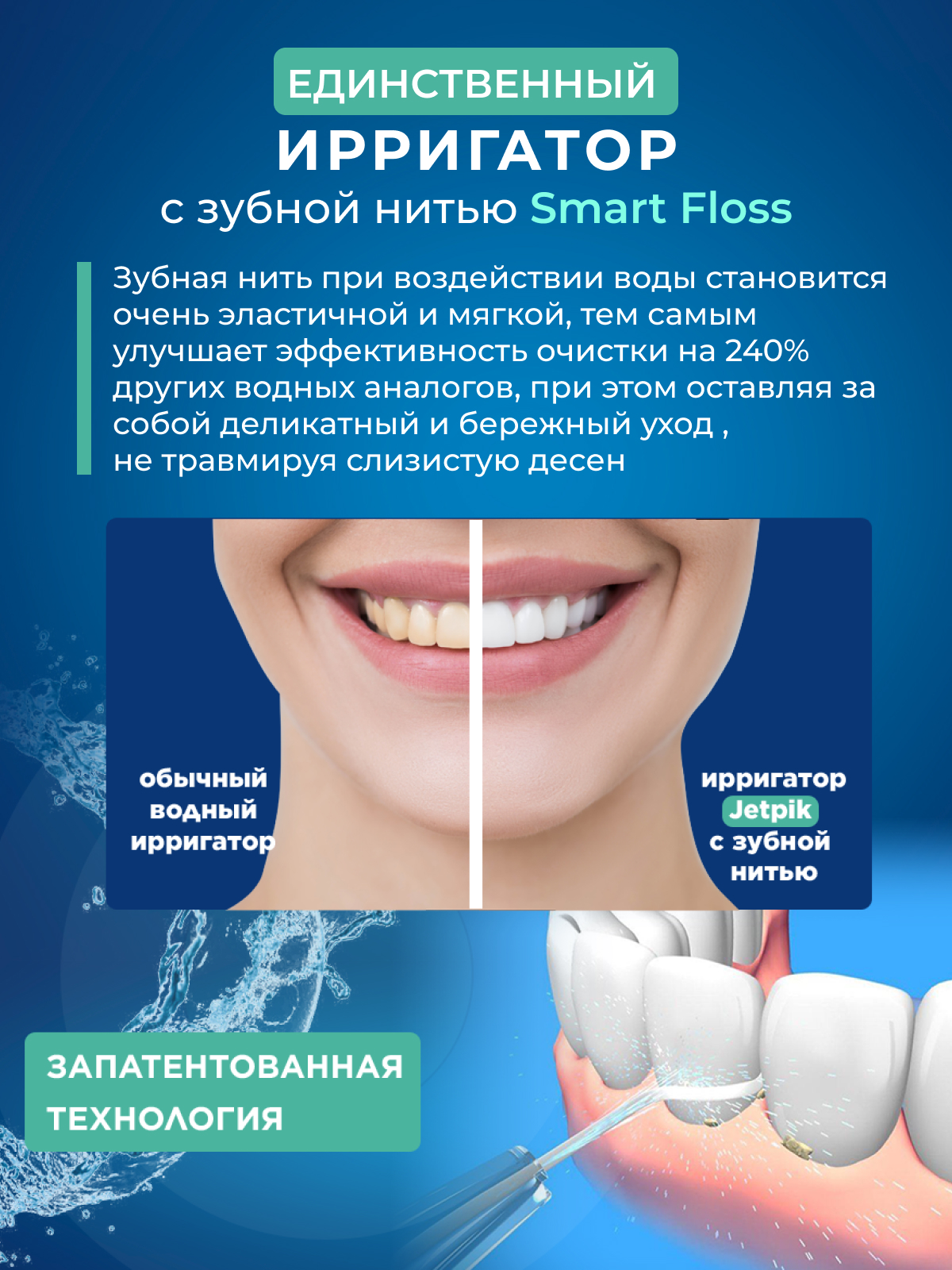 Ирригатор Jetpik ручной - фото 9