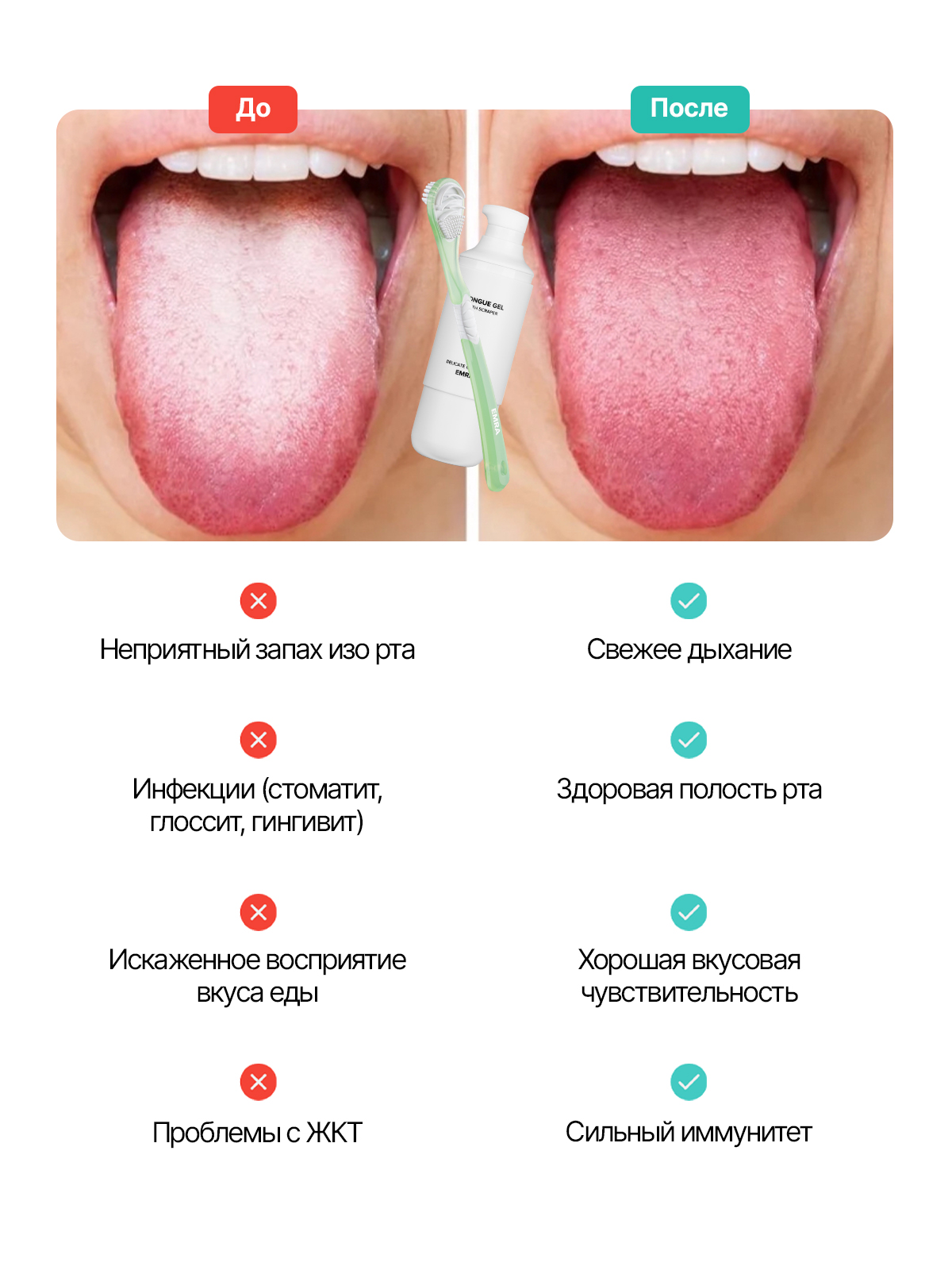 Скребок EMRA - фото 3