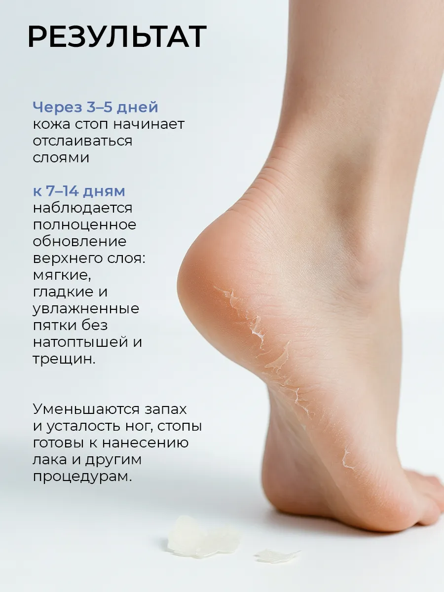 Носочки косметические SHARY - фото 2