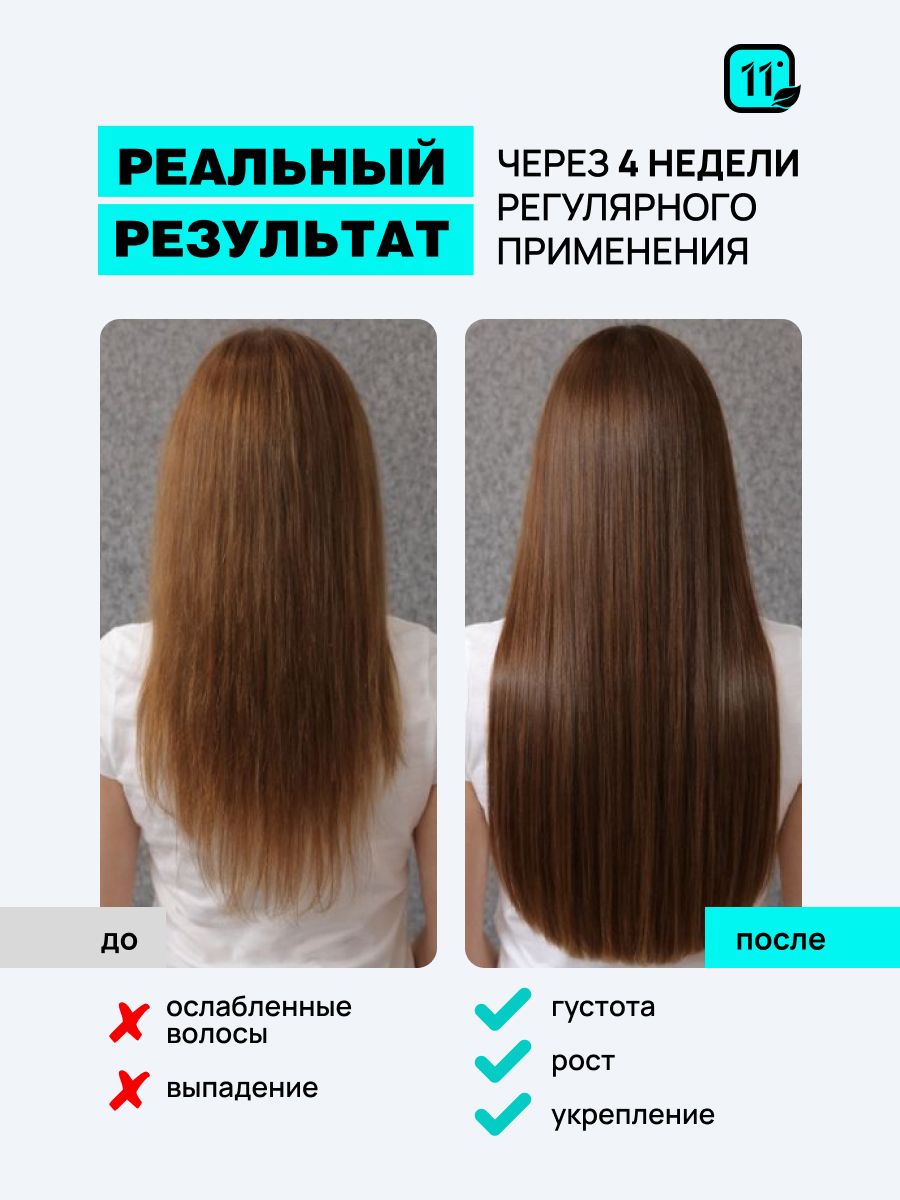 Лосьон 11i professional . Комплекс капиксил 10% 30 мл 1 шт. - фото 2