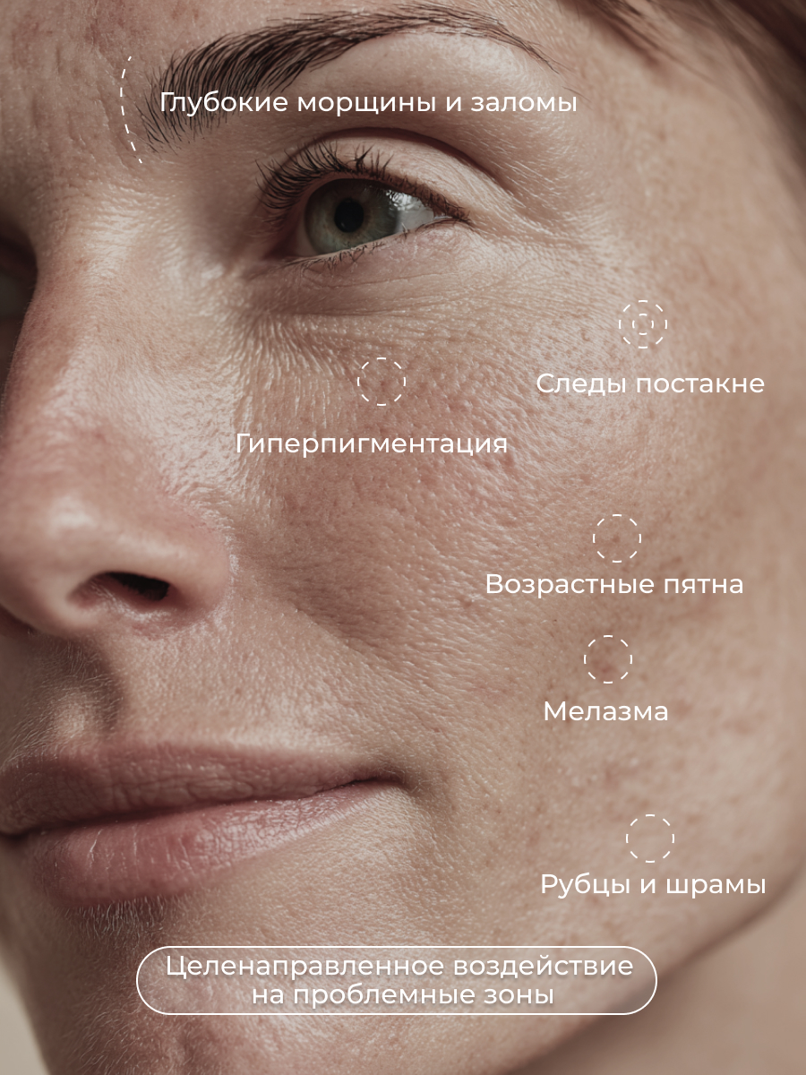 Сыворотка АКАВИЯ с микроиглами 6000 ppm - фото 4