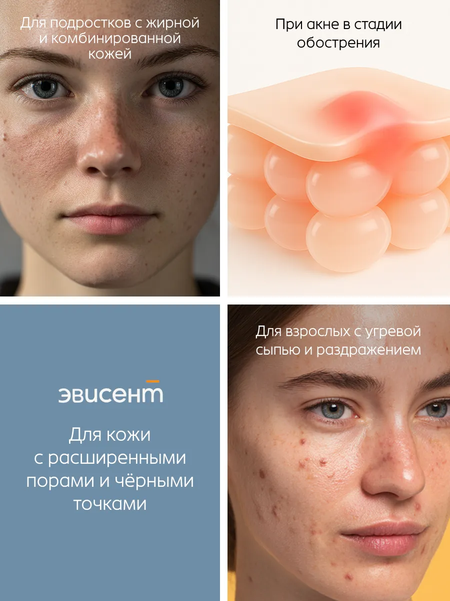 Пена Эвисент Anti-Acne Complex 160 мл - фото 4