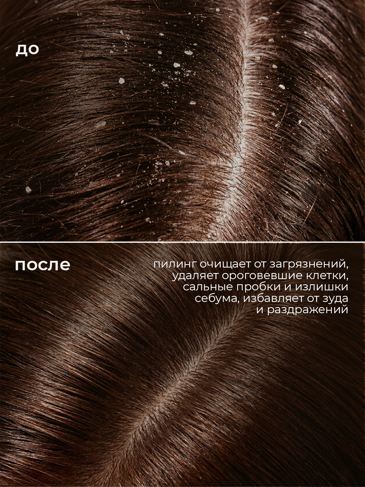 Мягкий пилинг для очищения кожи головы PRODIVA 100 мл - фото 4