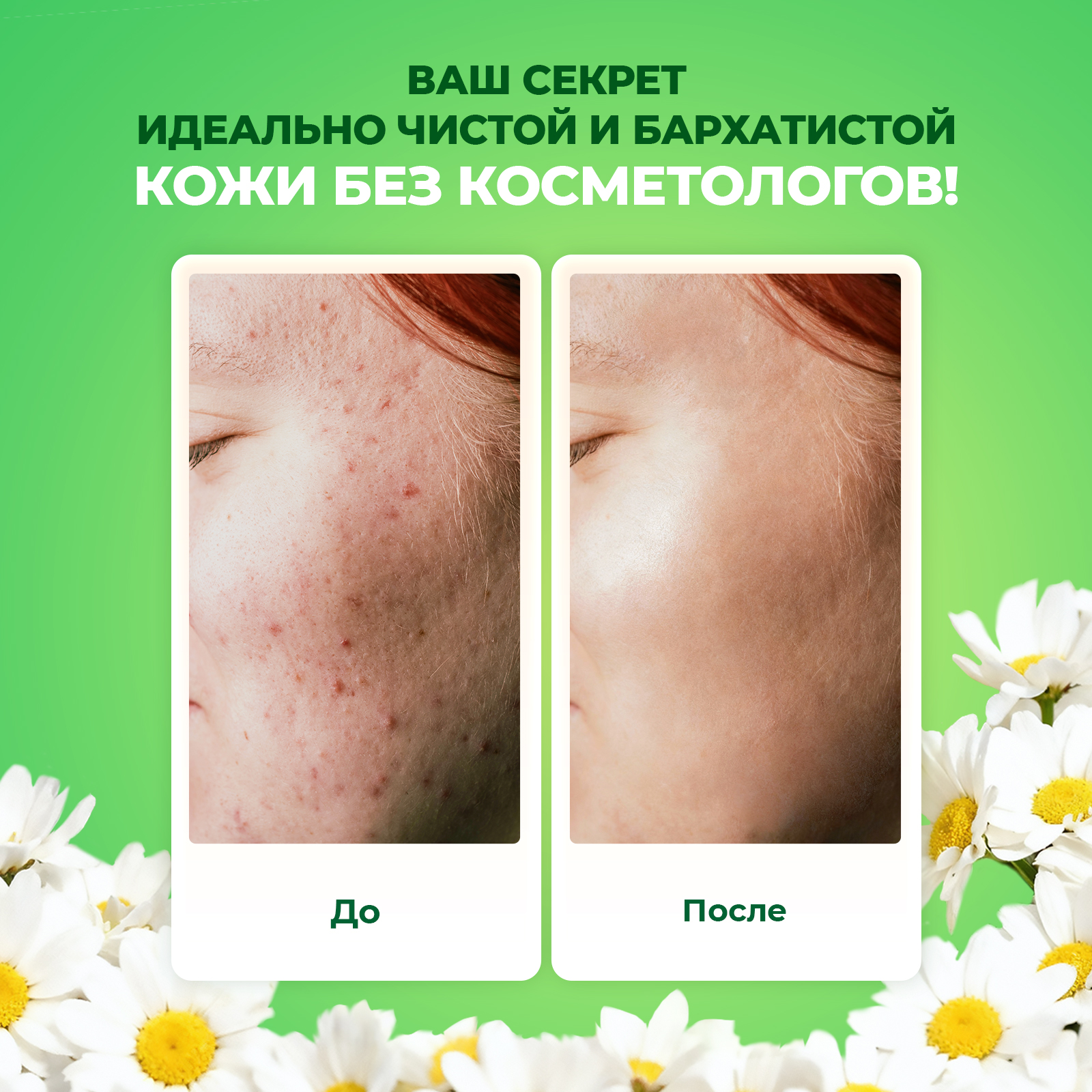 Патчи YesMix 95 мл 1 шт. - фото 2