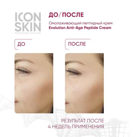 Крем ICON SKIN
