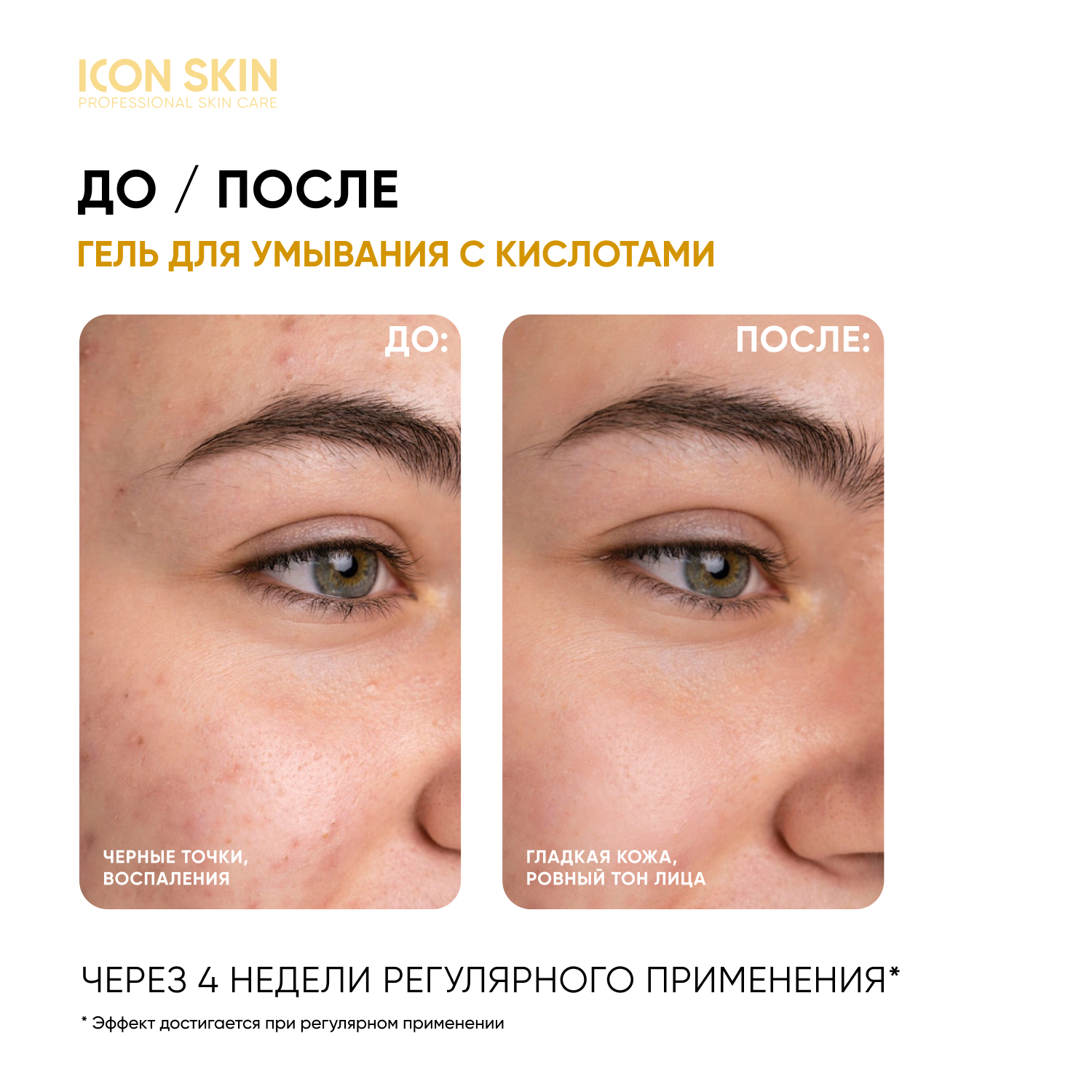 Гель ICON SKIN 150 мл - фото 2