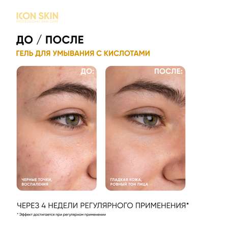 Гель ICON SKIN 150 мл
